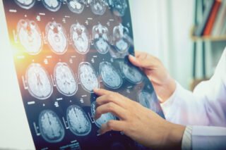 Career Comparison Between Radiologist and Radiographer