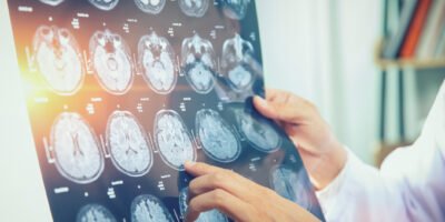 Career Comparison Between Radiologist and Radiographer