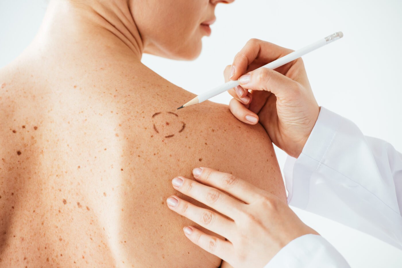 Dermatology