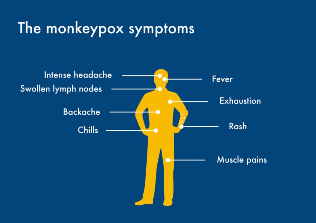 Monkeypox Symptoms