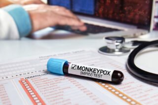 Monkeypox in 2026: What You Need to Know
