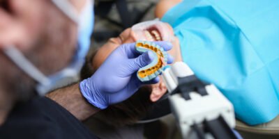 The Latest Trends in Porcelain Veneer Technology