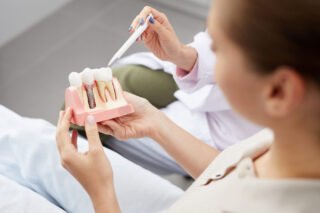 Before And After All On 4 Dental Implants: A Comprehensive Guide
