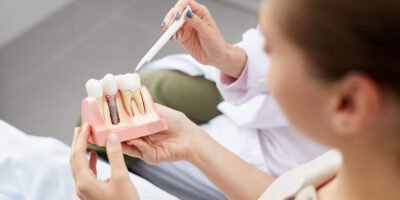Before And After All On 4 Dental Implants: A Comprehensive Guide