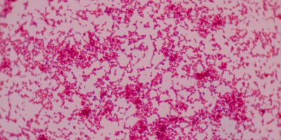 Beyond Blood Supply: Tumor Angiogenesis and its Role in Cancer Progression