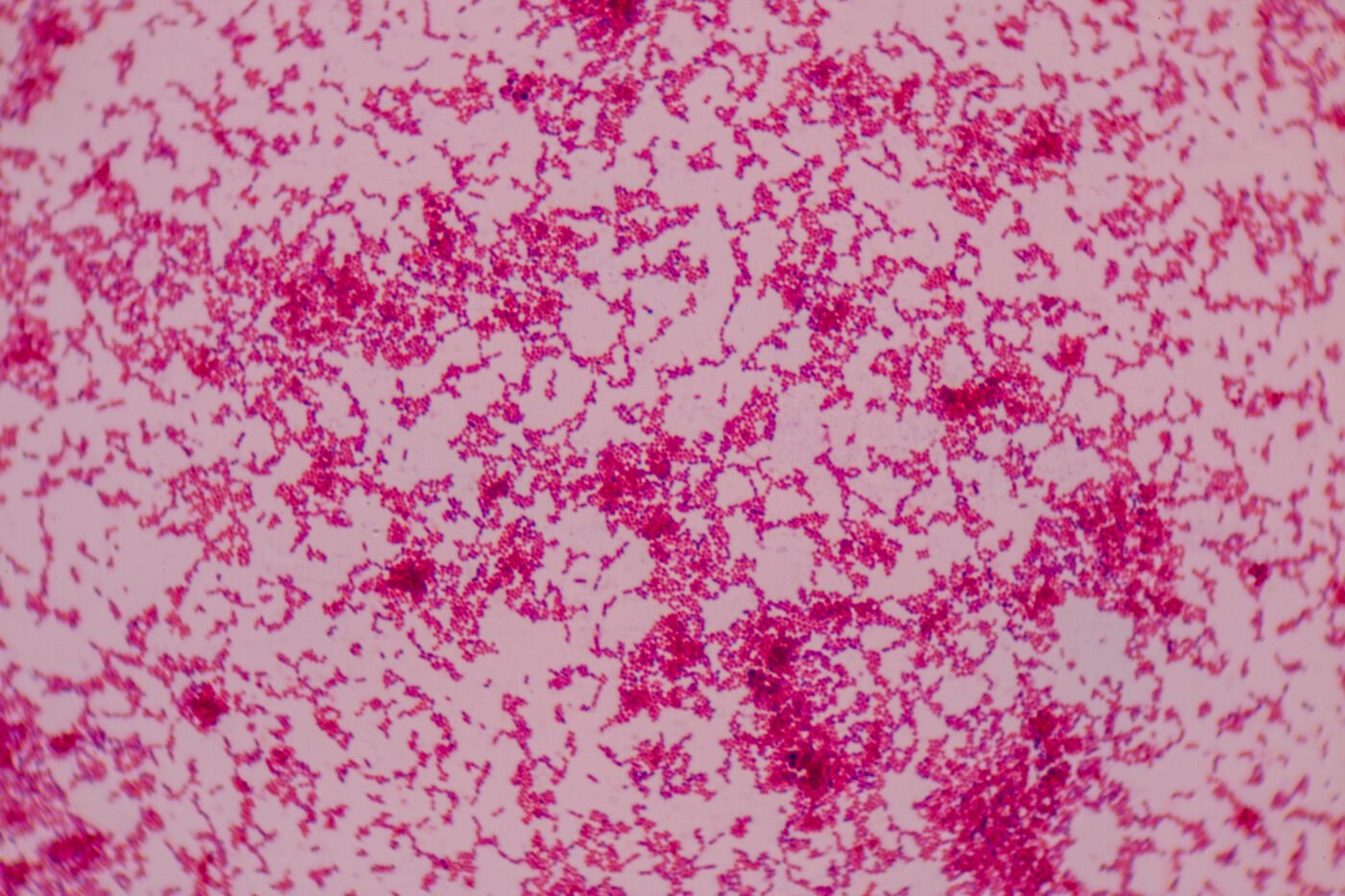 Beyond Blood Supply: Tumor Angiogenesis and its Role in Cancer Progression